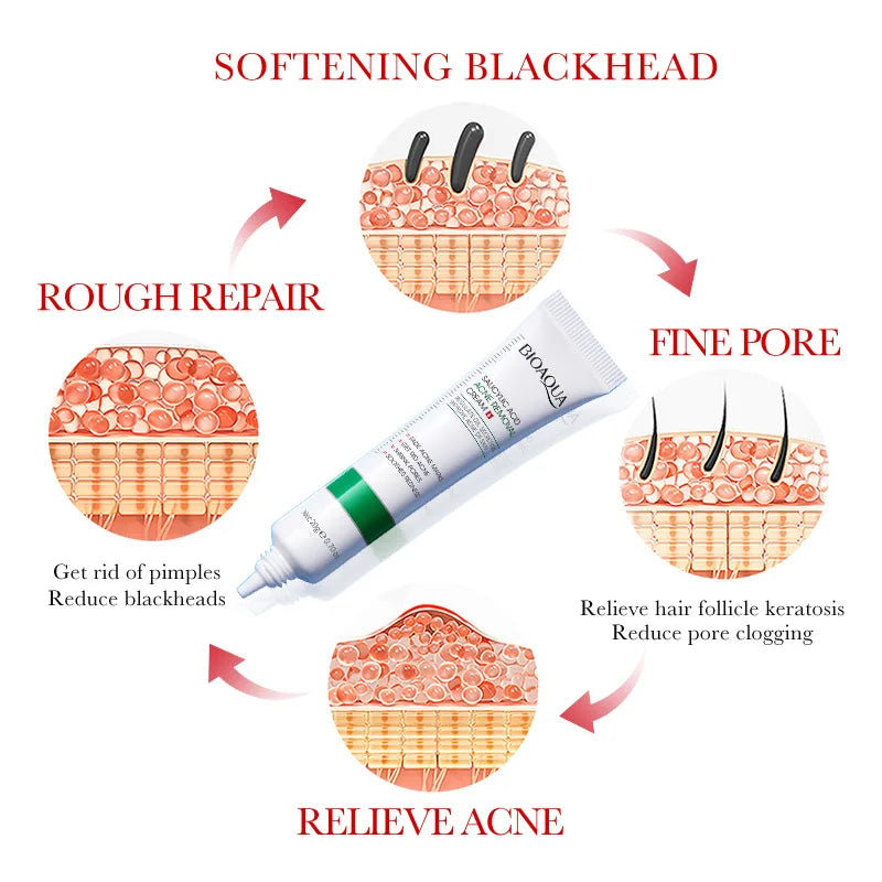 Salicylic Acid Shrink Pore Cream Elimination Large Pores Remove Blackehead Oil Control Face Smooth Repairing Skin Care Products