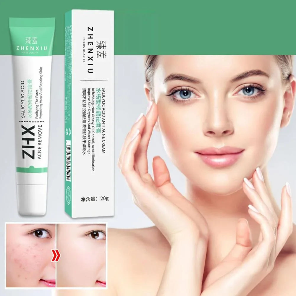 Salicylic Acid Shrink Pore Cream Elimination Large Pores Remove Blackehead Oil Control Face Smooth Repairing Skin Care Products