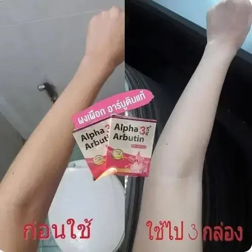 Alpha Arbutin 3 Plus Powder Mix With Lotion Skin Lightening Brighten Reduce Dark Spots Melanin Acne Scars Soft and smooth skin 
