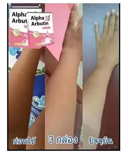Alpha Arbutin 3 Plus Powder Mix With Lotion Skin Lightening Brighten Reduce Dark Spots Melanin Acne Scars Soft and smooth skin 