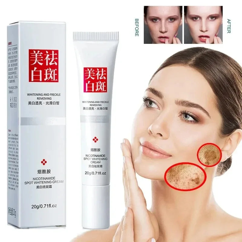 Fade and Improve Freckles Black Spots Face Cream Whitening Cream Removes Dark Melanin Brightens Skin Quickly Nourishes Skin 